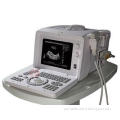 3.5MHz R60 - Frame Portable Ultrasound Scanner With Video O